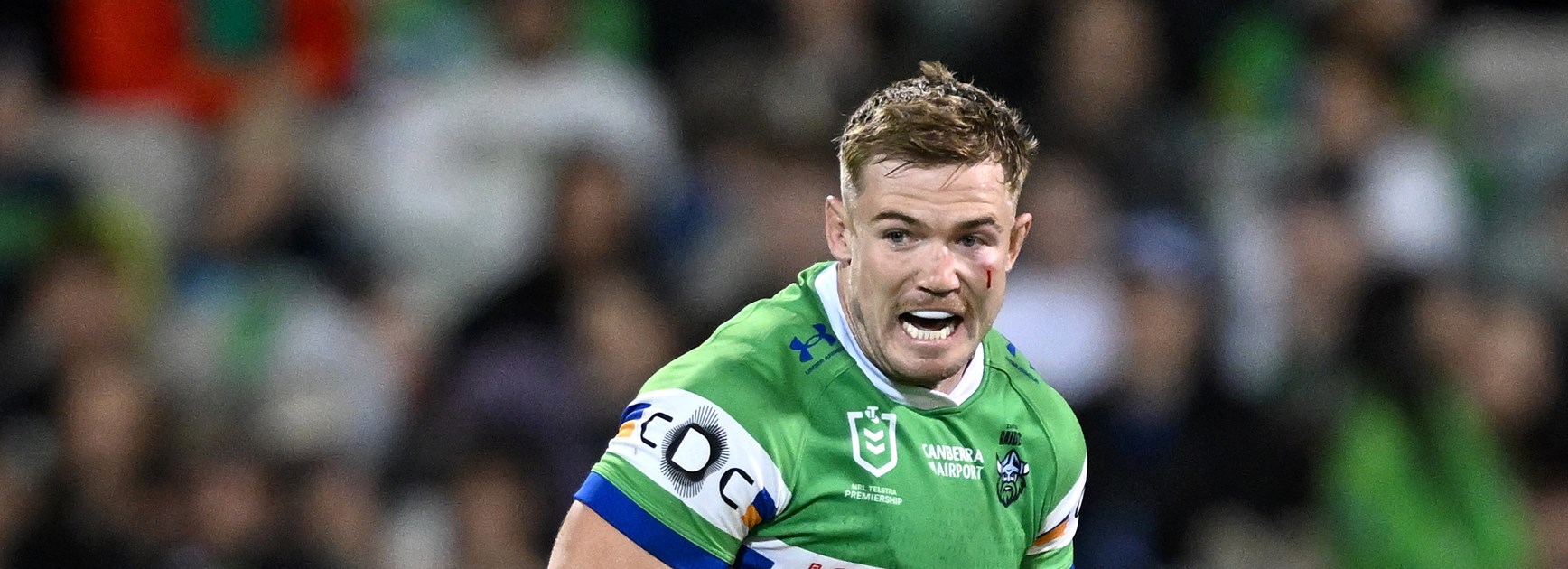 NRL Late Mail: Raiders v Bulldogs